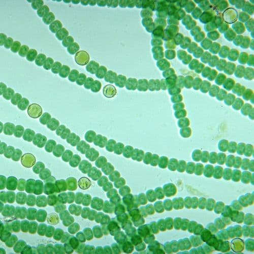 cyanobacteria