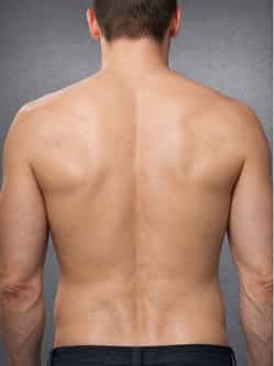 Vestigial Organs 3 Human Back No Vestigial Organs